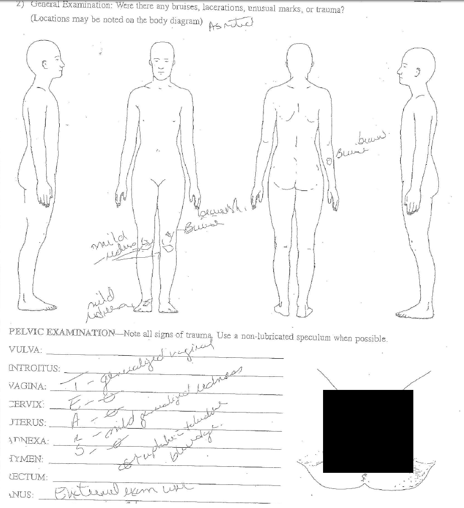 Medical Diagram Report of the accuser done by the Sexual Assault Nurse Examiner (SANE) at TMH.